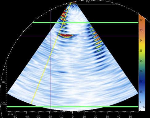 Webinar: Inspección de tornillos y bridas utilizando Phased Array | martes 19 de mayo 16 hs.